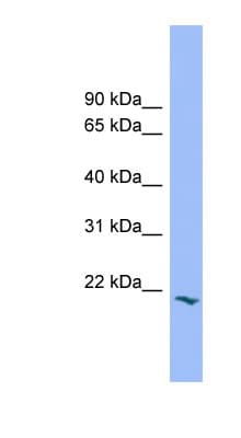 PRGP2 / PRRG2 Antibody (aa71-120)