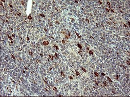 MMP13 Antibody (aa104-471, clone OTI1G5)