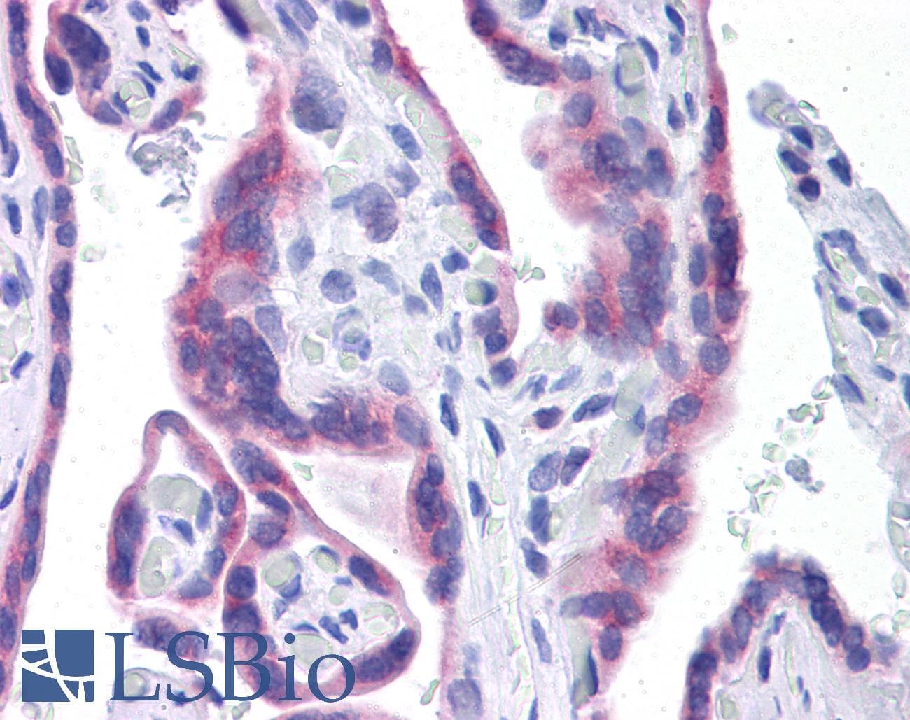 IHC-plus™ STT3A / ITM1 Antibody (clone 4D4)