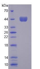 Mouse CSF2 / GM-CSF Protein (Recombinant His-GST, N-terminus)