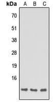 Apolipoprotein C-I Antibody (Internal)