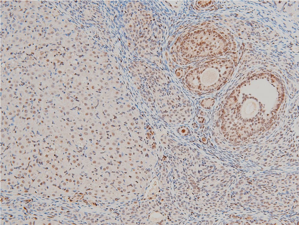 CFL1 / Cofilin Antibody (phospho-Ser3)