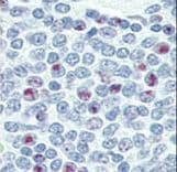 NANOG Antibody (aa15-49)