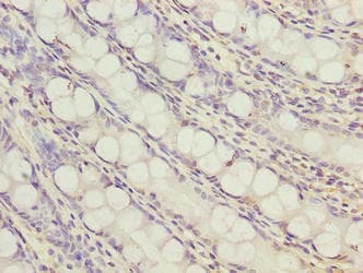 ZNF767 Antibody