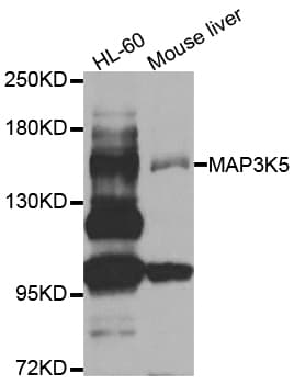 MAP3K5 / ASK1 Antibody
