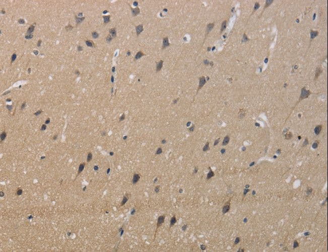 Polyclonal Rabbit anti-Human KCNMB4 Antibody (IHC, WB)