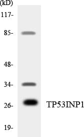 SIP / TP53INP1 Antibody (aa144-193)