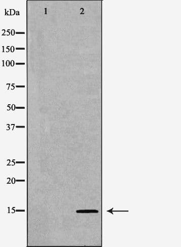 Polyclonal Rabbit anti-Human SPINLW1 / EPPIN Antibody (IHC, IF, WB)
