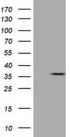 CAPZA1 / CAPZ Alpha 1 Antibody (clone OTI7C8, Carrier-free)