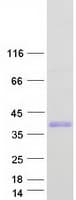 Human SKA1 Protein (Recombinant Myc-DDK (Flag))