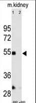 MMP12 Antibody (aa391-420)