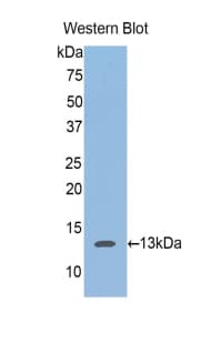 ACAN / Aggrecan Antibody (aa588-684)