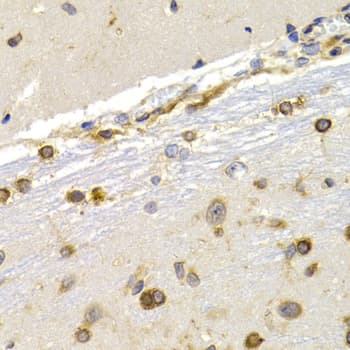 EEF1D Antibody