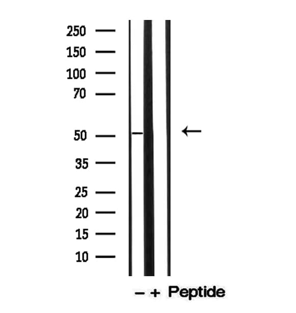 KRT13 / CK13 / Cytokeratin 13 Antibody