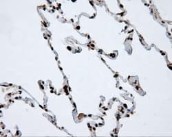 Monoclonal Mouse anti-Human ACLY / ATP Citrate Lyase Antibody (clone 3G8, Carrier-free, IHC, IF, WB)