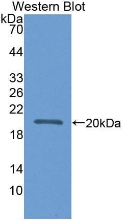 APOL2 / Apolipoprotein L 2 Antibody (aa186-337, Biotin)