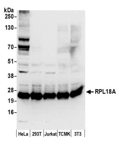 Polyclonal Rabbit anti-Human RPL18A Antibody (aa126-176, WB)