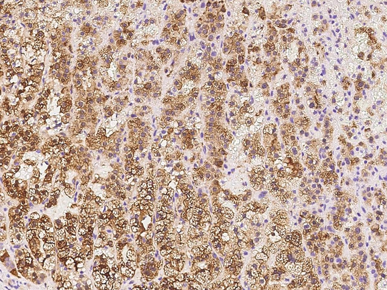SULT2A1 / Sulfotransferase 2A1 Antibody