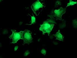 AKT1 Antibody (clone OTI4D6)