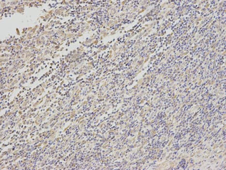 Tyrosinase Antibody