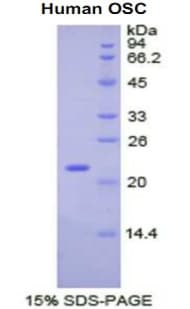 Human LSS Protein (Recombinant His)