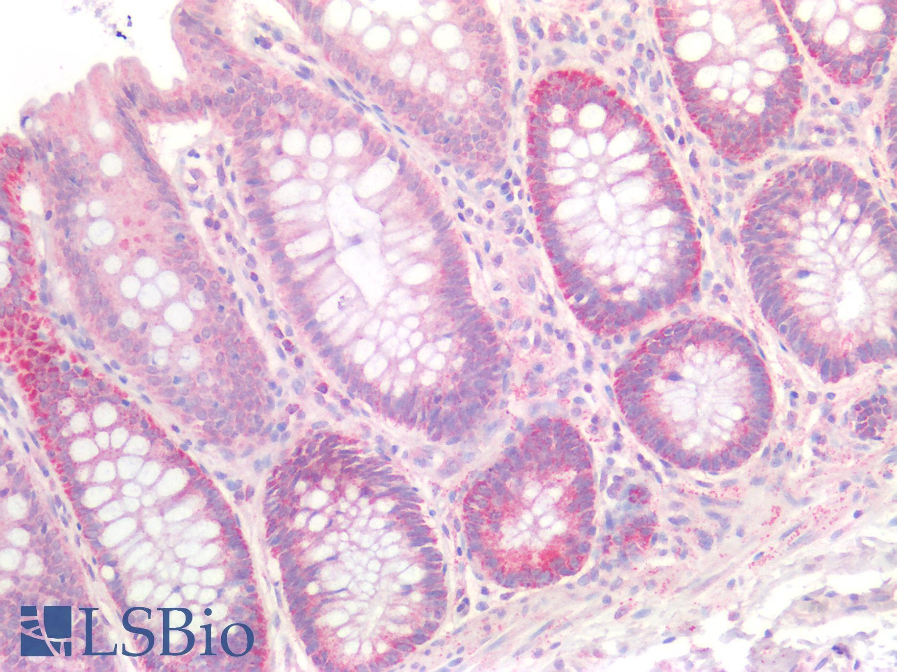 PathPlus™ Polyclonal Rabbit anti-Human CLDN3 / Claudin 3 Antibody (IHC)