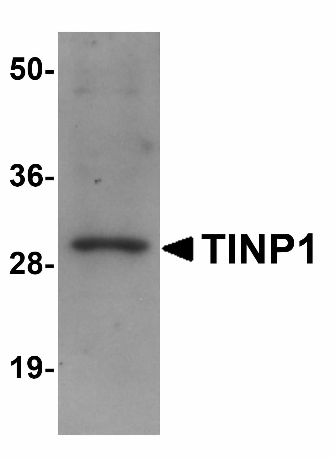 Hypothetical Protein / TINP1 Antibody