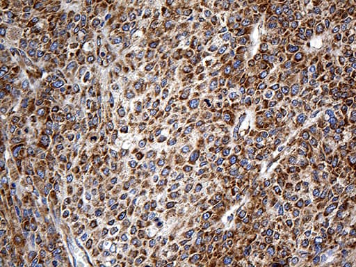 Monoclonal Mouse anti-Human RPSA / Laminin Receptor Antibody (clone OTI1G3, aa2-295, IHC, WB)