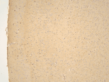 Polyclonal Rabbit anti-Human PPA1 Antibody (IHC, WB)