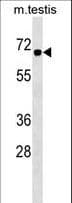 CBX2 Antibody (aa137-166)