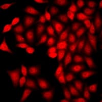 CAMK1D Antibody