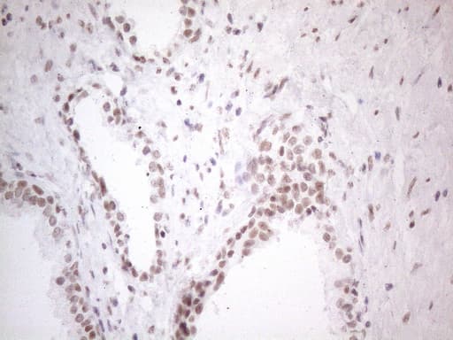 NR2C2 / TAK1 Antibody (aa1-241, clone OTI2H2)