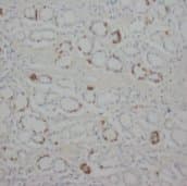 Polyclonal Rabbit anti-Human STAT1 Antibody (Sepharose, C-Terminus)