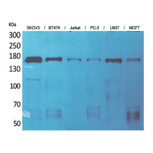 SYCP2 / SCP-2 Antibody (Internal)
