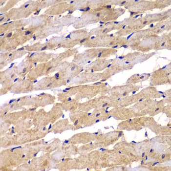 Polyclonal Rabbit anti-Human PSEN2 / Presenilin 2 Antibody (IHC, WB)
