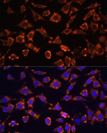 IL18 Antibody