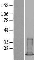S100A6 / Calcyclin Protein (Over-Expression Lysate Myc-DDK (Flag))