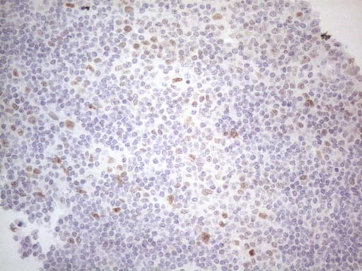 HDAC2 Antibody (aa415-488, clone OTI7E10)