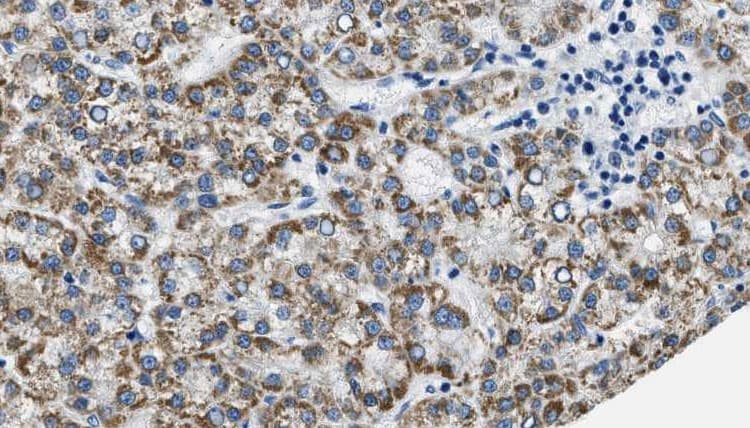 PTGER3 / EP3 Antibody