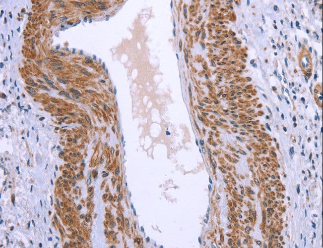 Polyclonal Rabbit anti-Human GNPAT / DHAP-AT Antibody (IHC)