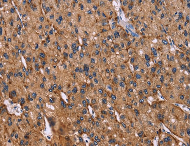 Polyclonal Rabbit anti-Human LAMP2 / CD107b Antibody (IHC)