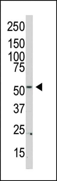 PI4K2B Antibody (aa1-30)