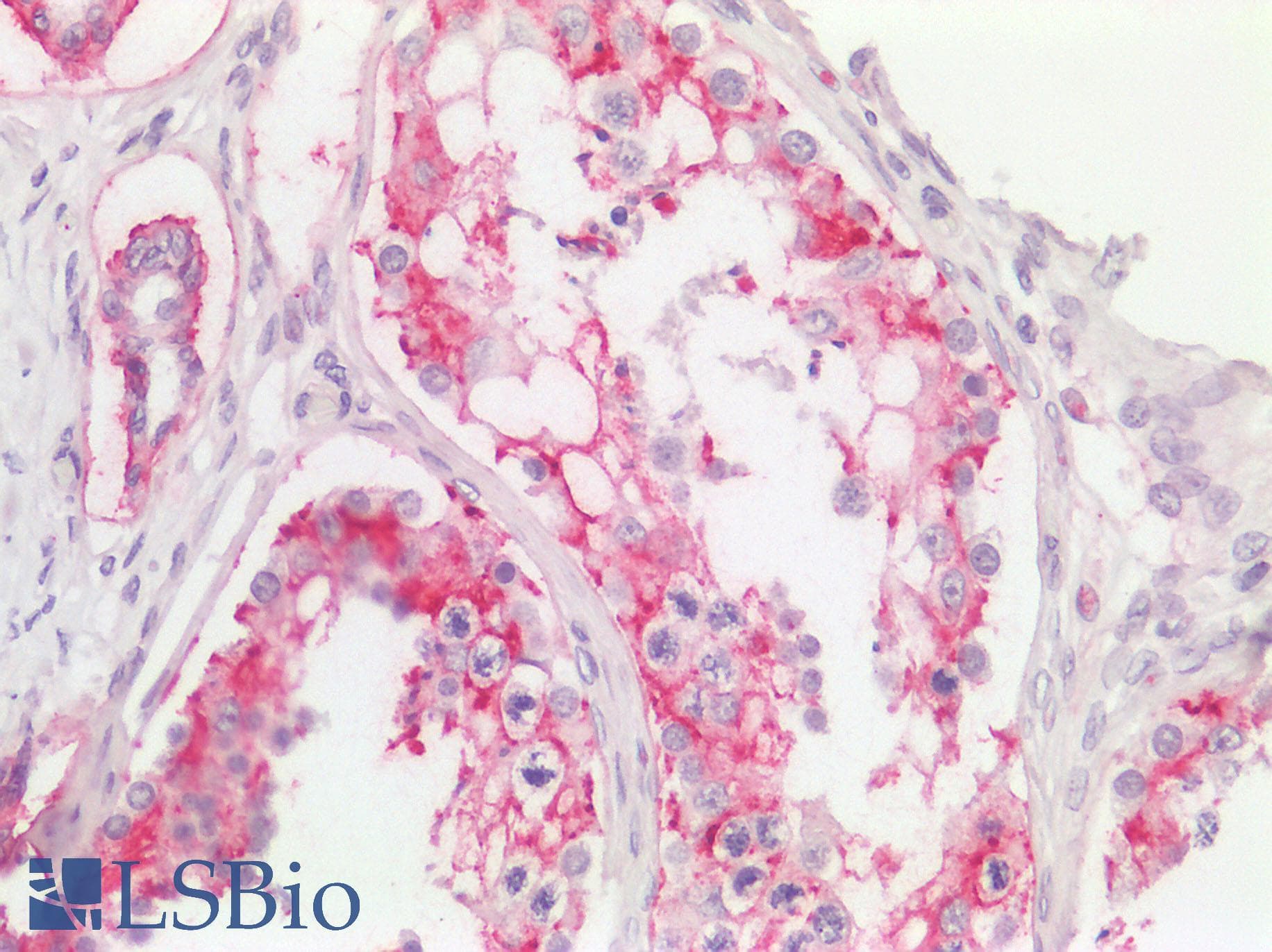 PathPlus™ Monoclonal Mouse anti-Human IL17A Antibody (clone 4K5F6, aa1-75, IHC, WB)