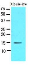 IHC-plus™ Monoclonal Mouse anti-Human CRABP1 / CRABP Antibody (clone AT1A1, IHC, WB)