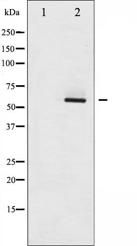 Polyclonal Rabbit anti-Human ESR2 / ER Beta Antibody (phospho-Ser105, IF, WB)