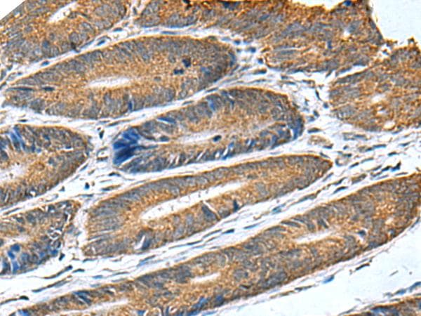 HSD11B1 / HSD11B Antibody