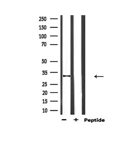 Polyclonal Rabbit anti-Human HMOX1 / HO-1 Antibody (IHC, WB)