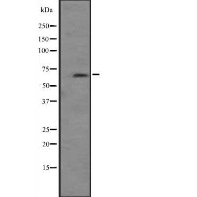 PRKCI / PKC Iota Antibody