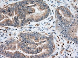 IGF2BP2 Antibody (clone OTI1F9, Carrier-free)