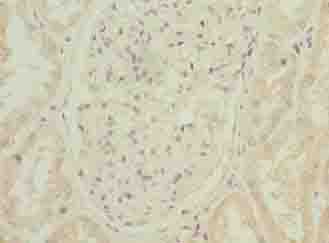 Polyclonal Rabbit anti-Human ARPIN / C15orf38 Antibody (IHC, WB)